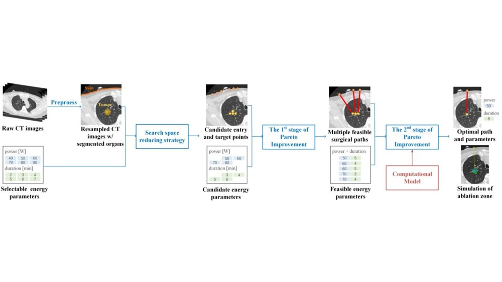 Treatment planning workflow for percutaneous microwave ablation of lung tumors